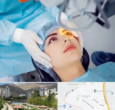 دکتر عمل لیزیک چشم در شهر زیبا
