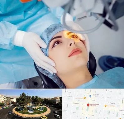 دکتر عمل لیزیک چشم در هفت حوض