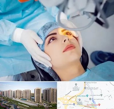 دکتر عمل لیزیک چشم در المپیک