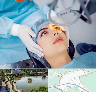 دکتر عمل لیزیک چشم در لنگرود