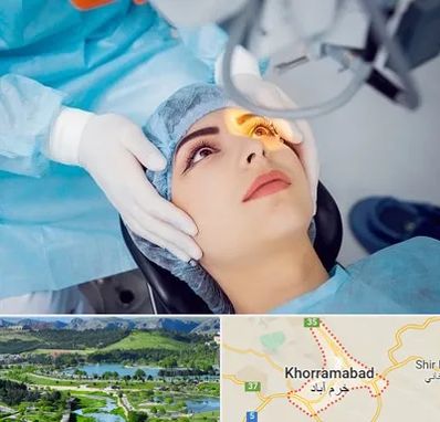 دکتر عمل لیزیک چشم در خرم آباد