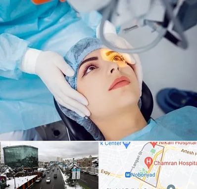 دکتر عمل لیزیک چشم در اقدسیه