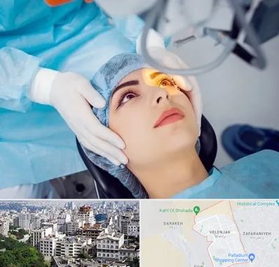 دکتر عمل لیزیک چشم در ولنجک