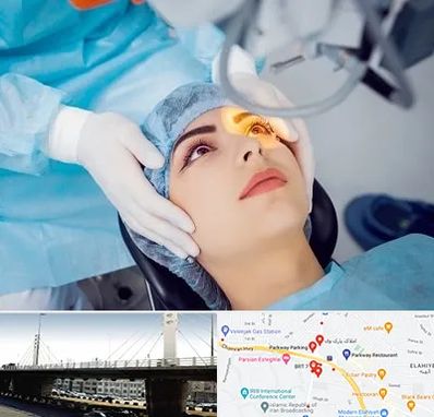 دکتر عمل لیزیک چشم در پارک وی