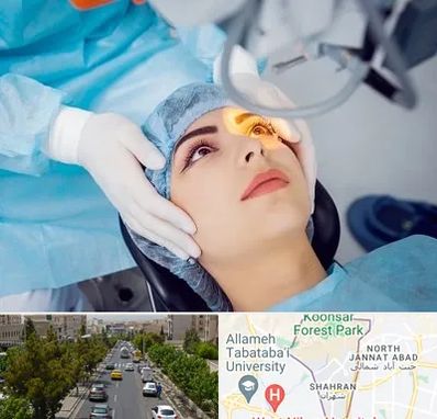 دکتر عمل لیزیک چشم در شهران