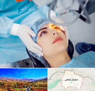 دکتر عمل لیزیک چشم در خراسان شمالی
