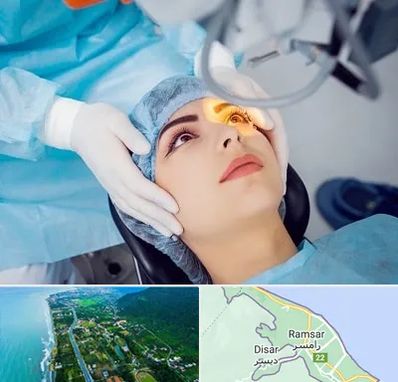 دکتر عمل لیزیک چشم در رامسر