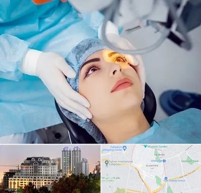 دکتر عمل لیزیک چشم در فرشته