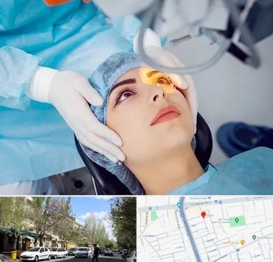 دکتر عمل لیزیک چشم در کوی فیروز تبریز