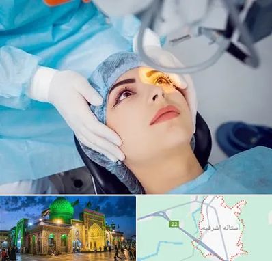 دکتر عمل لیزیک چشم در آستانه اشرفیه