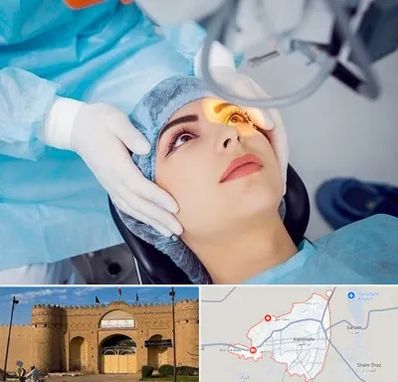 دکتر عمل لیزیک چشم در ایرانشهر