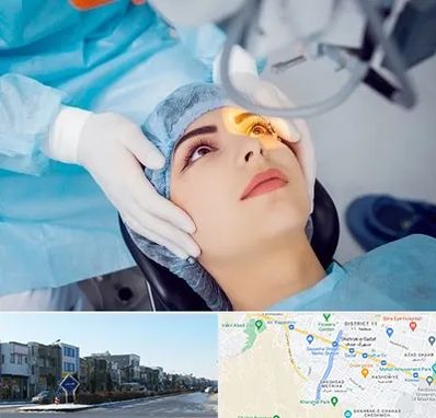 دکتر عمل لیزیک چشم در شریعتی مشهد