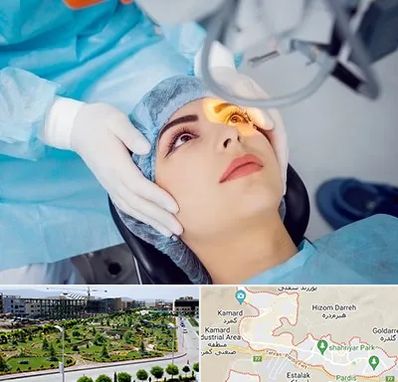 دکتر عمل لیزیک چشم در پردیس