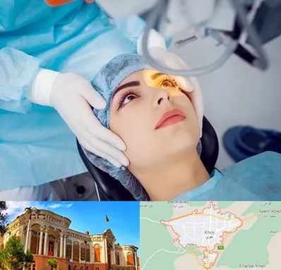 دکتر عمل لیزیک چشم در خوی