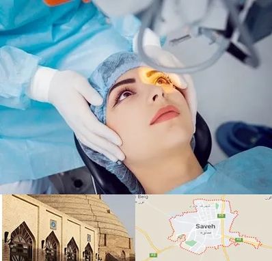 دکتر عمل لیزیک چشم در ساوه