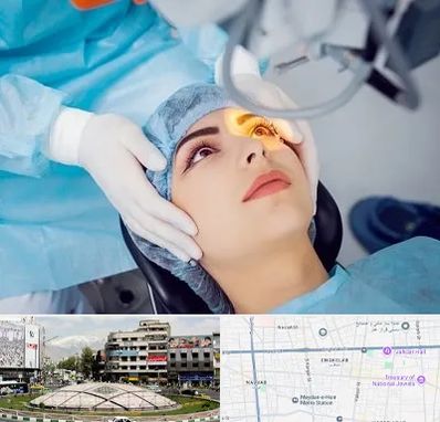 دکتر عمل لیزیک چشم در مرکز تهران