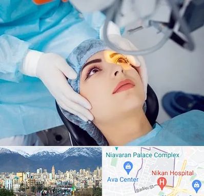 دکتر عمل لیزیک چشم در آجودانیه