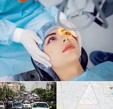 دکتر عمل لیزیک چشم در سیدی مشهد