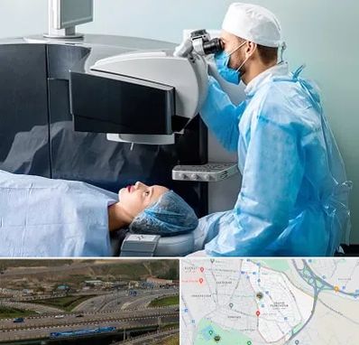 مرکز لیزیک چشم در یاغچیان تبریز