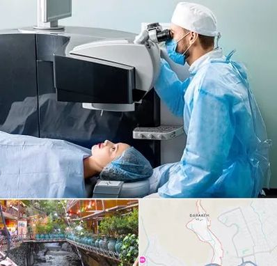 مرکز لیزیک چشم در درکه
