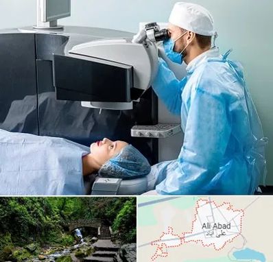 مرکز لیزیک چشم در علی‌ آباد کتول