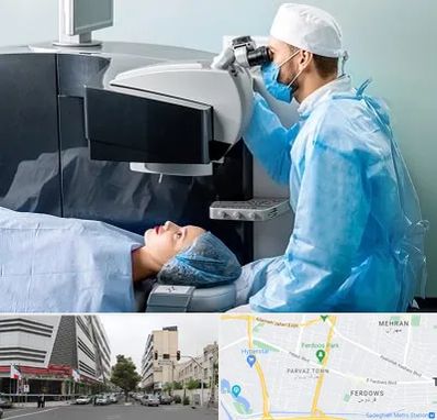 مرکز لیزیک چشم در بلوار فردوس