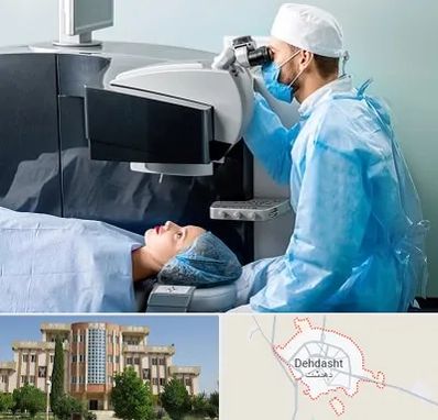 مرکز لیزیک چشم در دهدشت