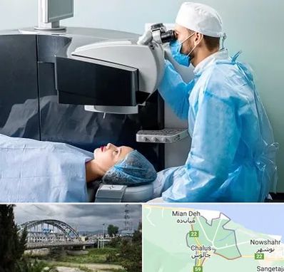 مرکز لیزیک چشم در چالوس