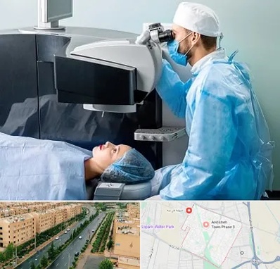 مرکز لیزیک چشم در فاز سه اندیشه
