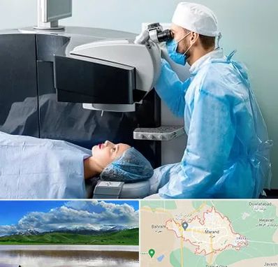 مرکز لیزیک چشم در مرند