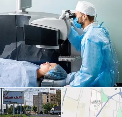 مرکز لیزیک چشم در فاز یک اندیشه