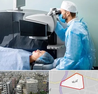 مرکز لیزیک چشم در آذری