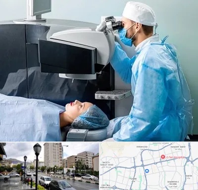 مرکز لیزیک چشم در شمال غرب تهران