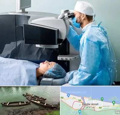 مرکز لیزیک چشم در بندر انزلی