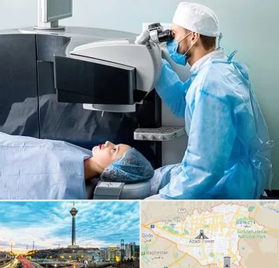 مرکز لیزیک چشم در تهران