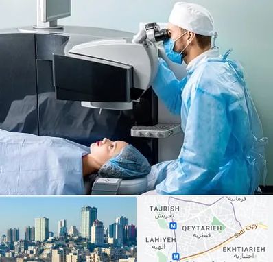 مرکز لیزیک چشم در قیطریه