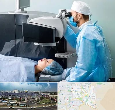 مرکز لیزیک چشم در منطقه 15 تهران