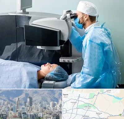 مرکز لیزیک چشم در شمال شرق تهران