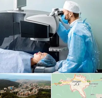 مرکز لیزیک چشم در گرگان