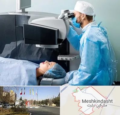 مرکز لیزیک چشم در مشکین دشت