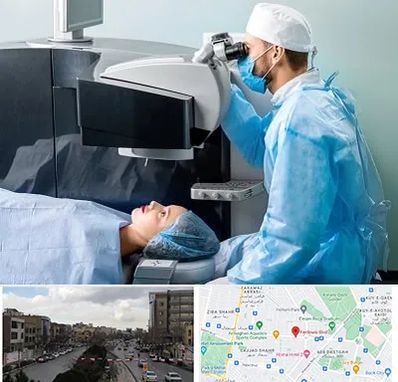 مرکز لیزیک چشم در بلوار فردوسی مشهد