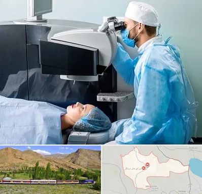 مرکز لیزیک چشم در خاش