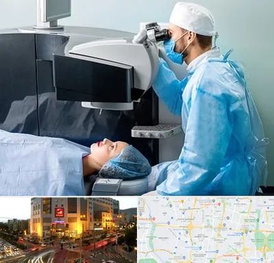 مرکز لیزیک چشم در جنت آباد تهران