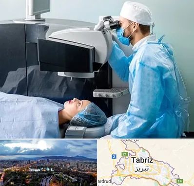 مرکز لیزیک چشم در تبریز