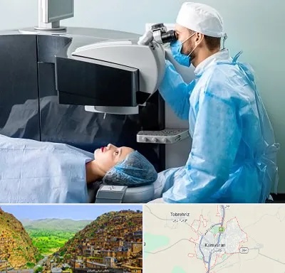 مرکز لیزیک چشم در کامیاران