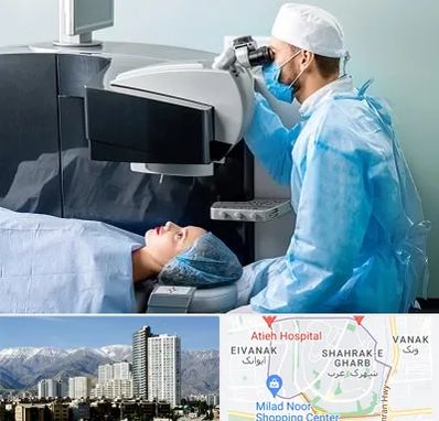 مرکز لیزیک چشم در شهرک غرب تهران