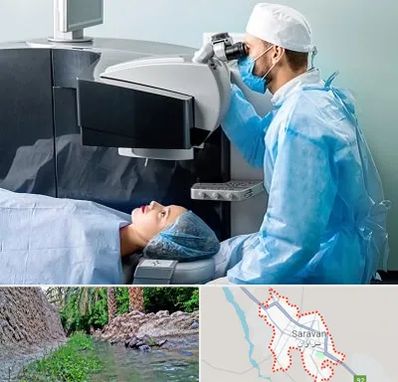 مرکز لیزیک چشم در سراوان