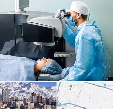 مرکز لیزیک چشم در ازگل