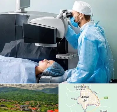 مرکز لیزیک چشم در آمل