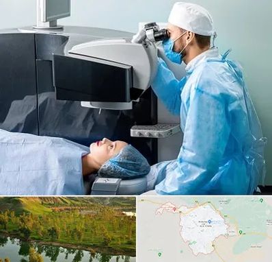 مرکز لیزیک چشم در بهبهان